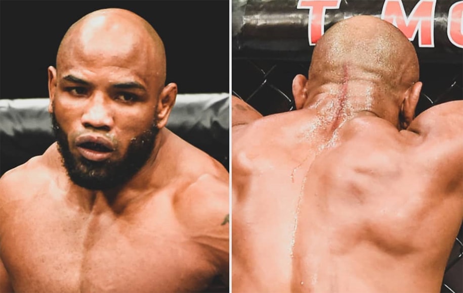 Những điều có thể bạn chưa biết về “Soldier of God” Yoel Romero